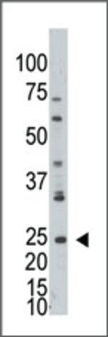 Anti-ADPRH (C-term) antibody produced in rabbit