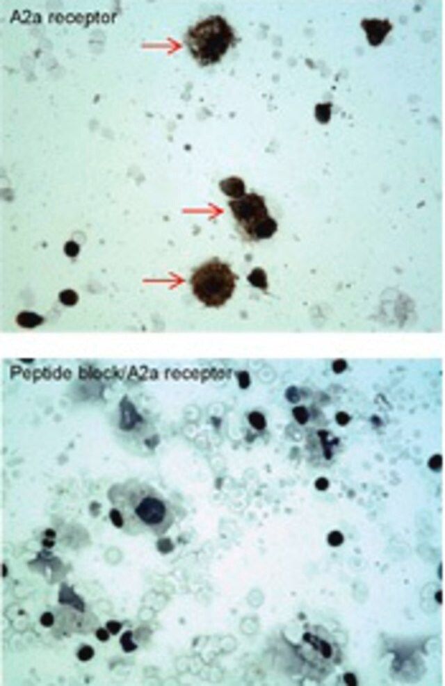 Anti-ADORA2A (C-terminal) antibody produced in rabbit