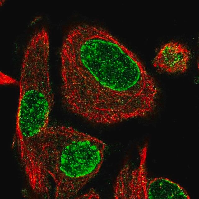 Anti-ADPRH antibody produced in rabbit