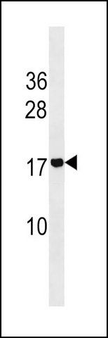 ANTI-ADM2 (N-TERM) antibody produced in rabbit