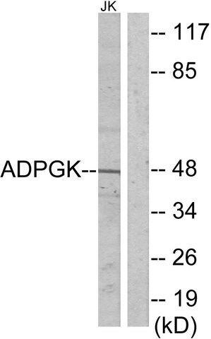 Anti-ADPGK antibody produced in rabbit