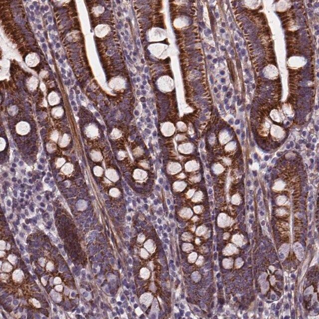 Anti-AEBP1 antibody produced in rabbit