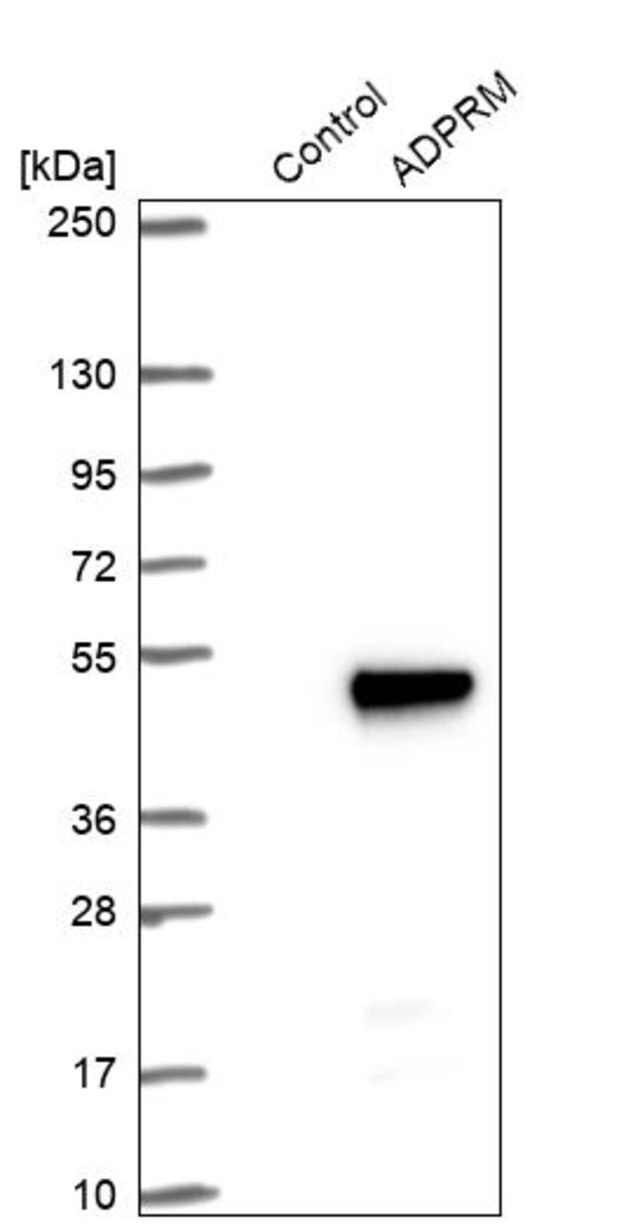 Anti-ADPRM antibody produced in rabbit