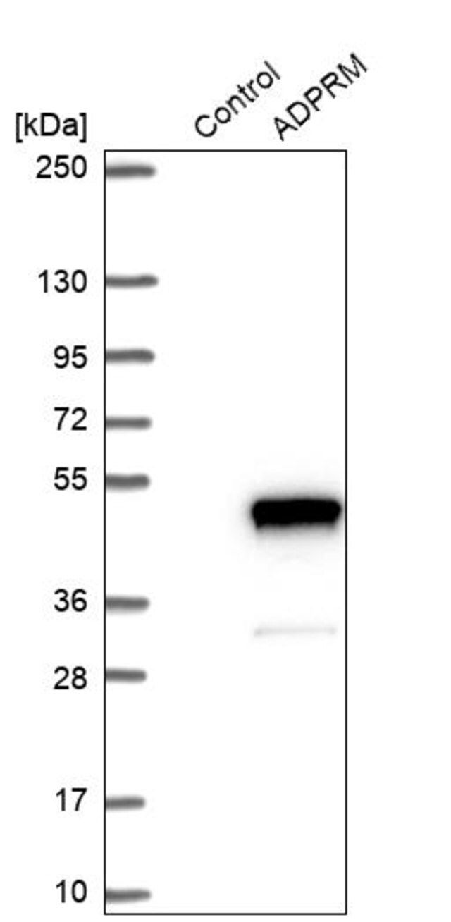 Anti-ADPRM antibody produced in rabbit