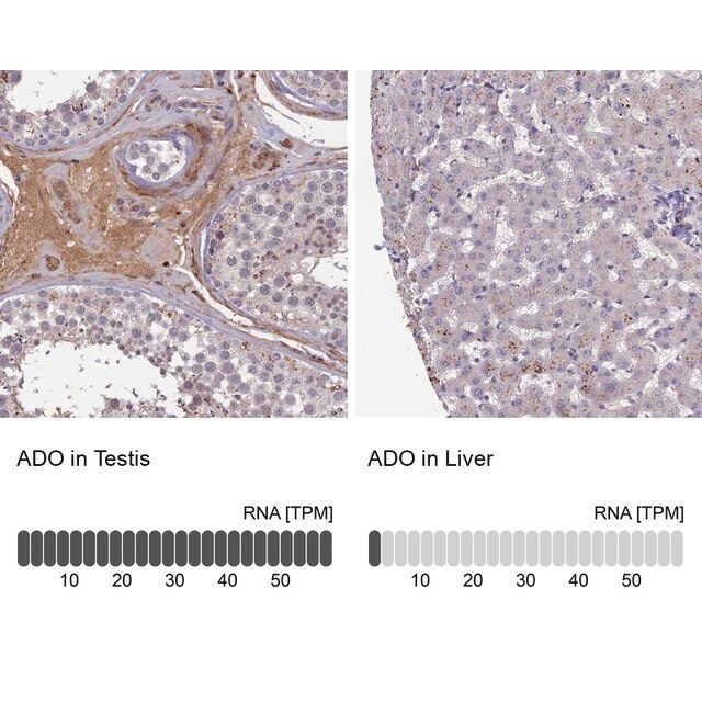 Anti-ADO antibody produced in rabbit