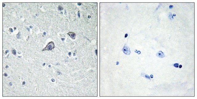 Anti-ADORA2A antibody produced in rabbit