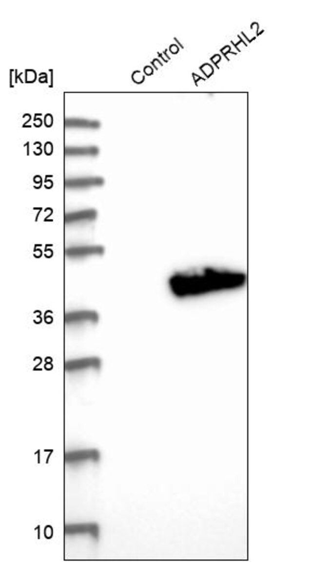 Anti-ADPRHL2 antibody produced in rabbit