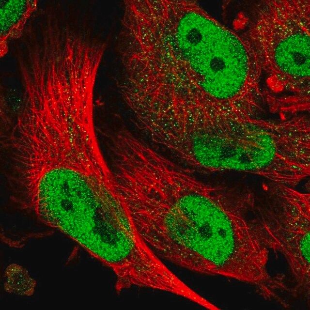 Anti-ABCA1 antibody produced in rabbit