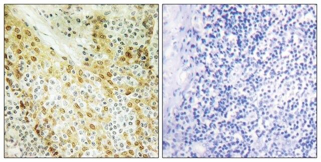 Anti-HIRA antibody produced in rabbit