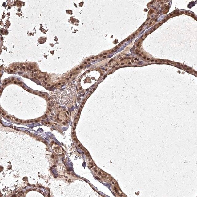 Anti-ING5 antibody produced in rabbit