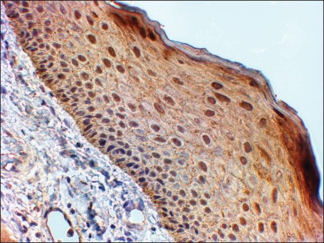 Anti-14-3-3 SIGMA/STRATIFIN antibody produced in goat