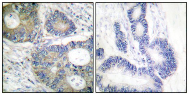 Anti-4E-BP1 antibody produced in rabbit