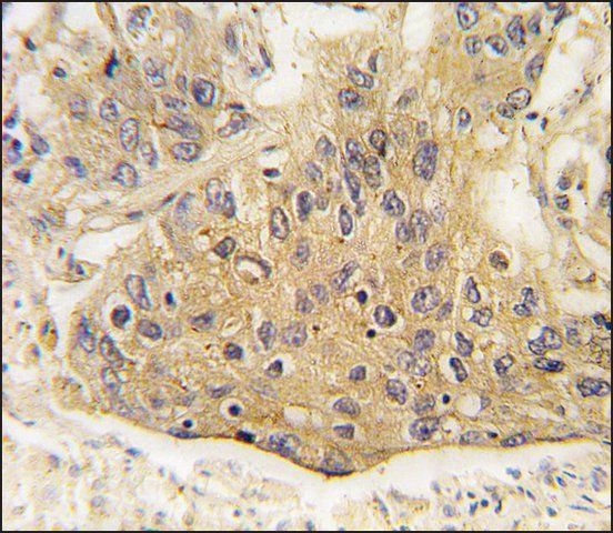 Anti-AARS2 (center) antibody produced in rabbit