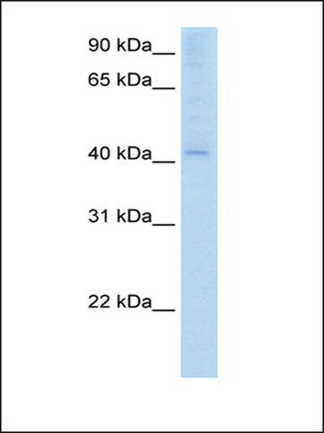 Anti-AADAC antibody produced in rabbit