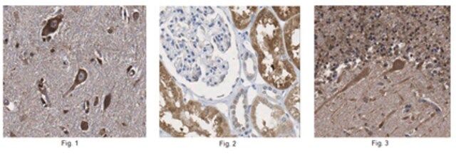 Anti-3-PGDH Antibody