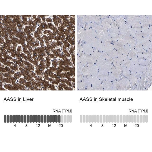 Anti-AASS antibody produced in rabbit