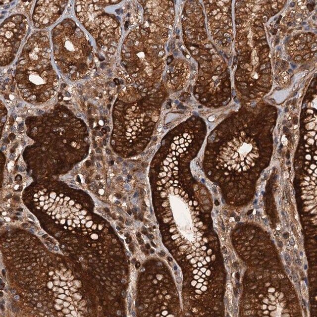 Anti-AAGAB antibody produced in rabbit