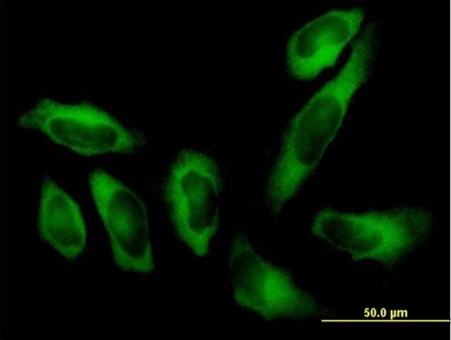 Anti-AARS antibody produced in mouse