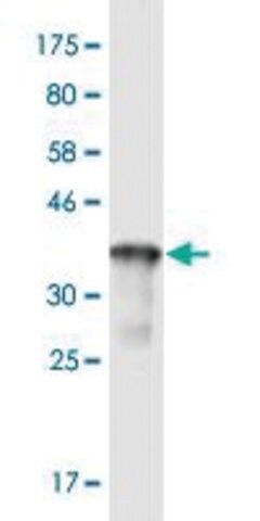 Monoclonal Anti-RRAS, (C-terminal) antibody produced in mouse