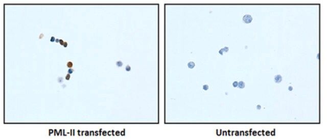 Anti-PML Isoform II Antibody, clone 1A8.1