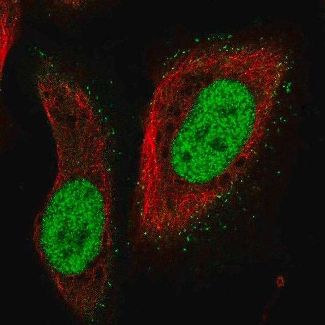 Anti-PMS2 antibody produced in rabbit