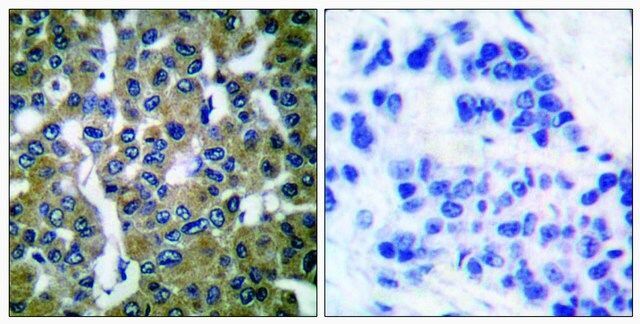 Anti-PLCG2 antibody produced in rabbit