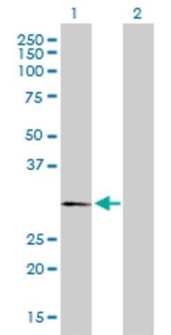 Anti-PLP1 antibody produced in rabbit