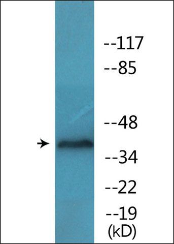 Anti-phospho-EFNB1 (pTyr<sup>317</sup>) antibody produced in rabbit