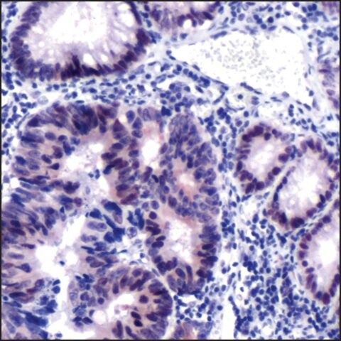 Anti-MSH2 antibody, Rabbit monoclonal