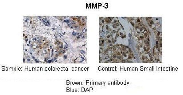 Anti-MMP3 antibody produced in rabbit