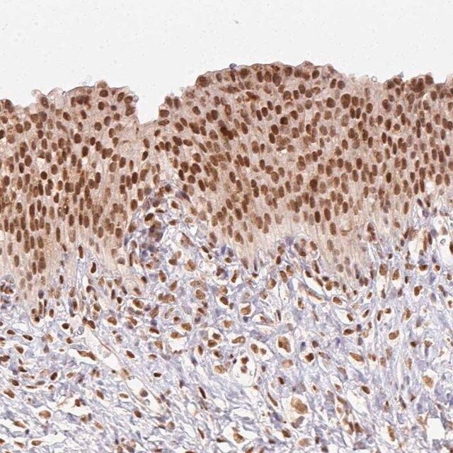 Anti-NFE2L1 antibody produced in rabbit