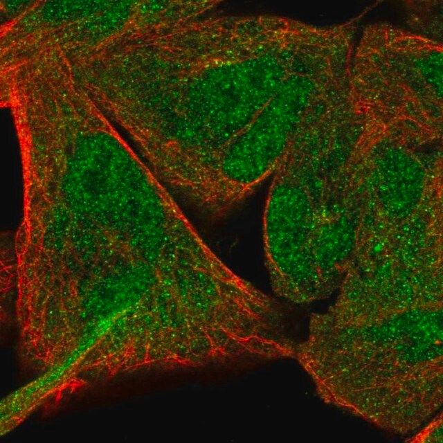 Anti-NFE2L1 antibody produced in rabbit