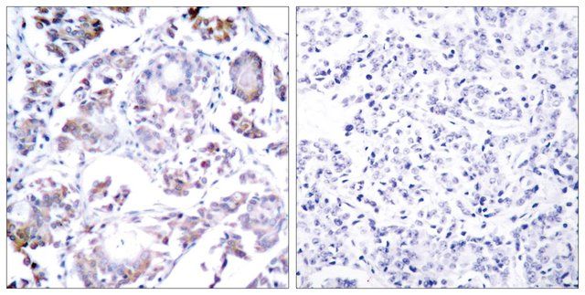 Anti-NF-B p65 antibody produced in rabbit