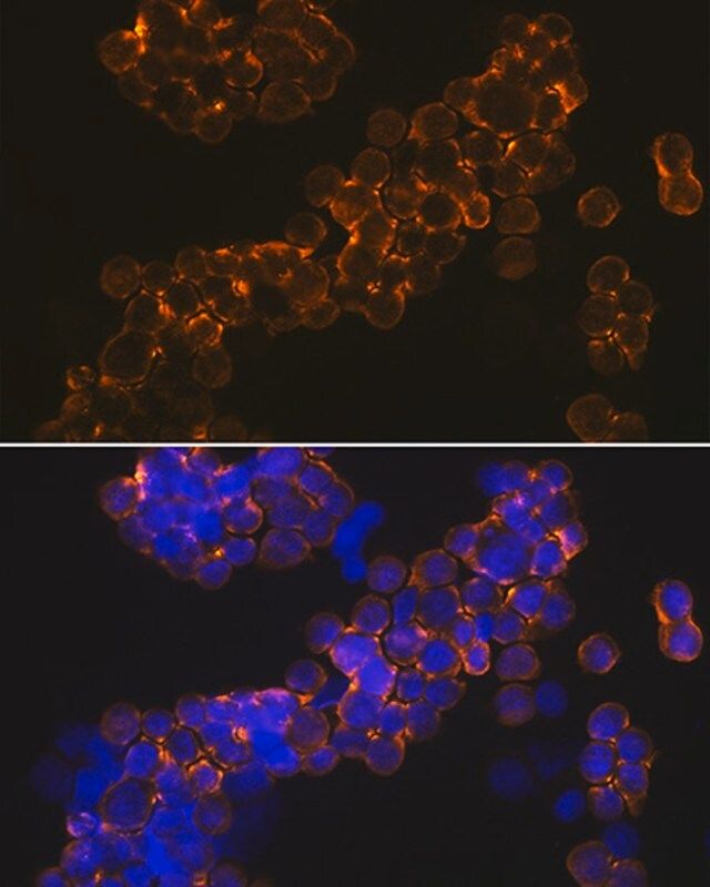 Anti-NMDAR1 antibody produced in rabbit