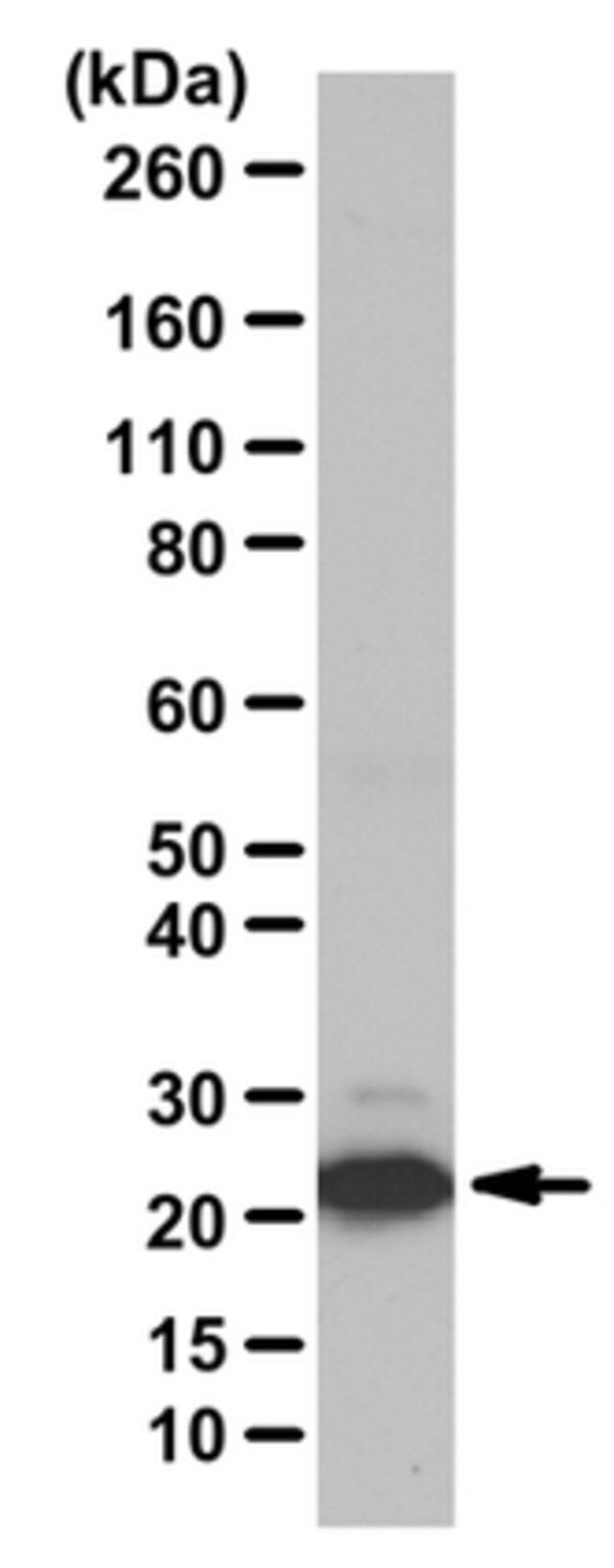 Anti-phospho BAD Antibody (Ser155)