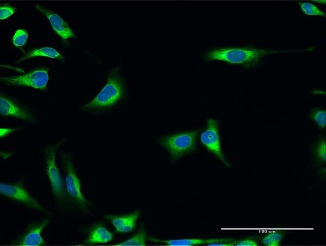 Anti-PDIA3 antibody produced in rabbit