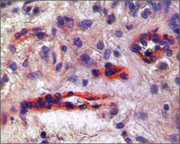 Anti-KDR antibody produced in rabbit