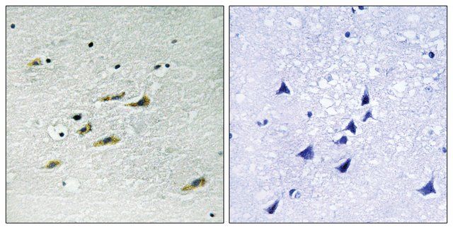 Anti-JAK2 antibody produced in rabbit