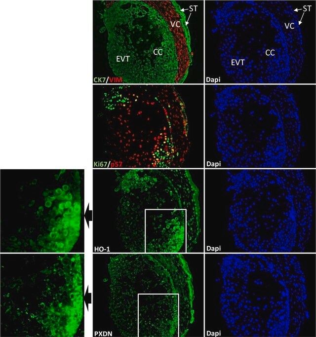 Anti-Ki-67 Antibody, clone Ki-S5