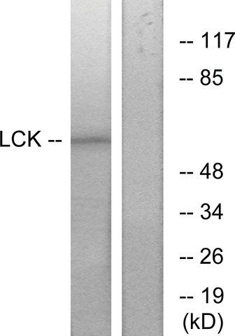 Anti-LCK antibody produced in rabbit