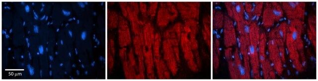 Anti-KIF23 antibody produced in rabbit