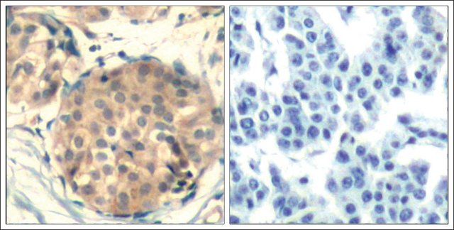 Anti-KIT (Ab-936) antibody produced in rabbit