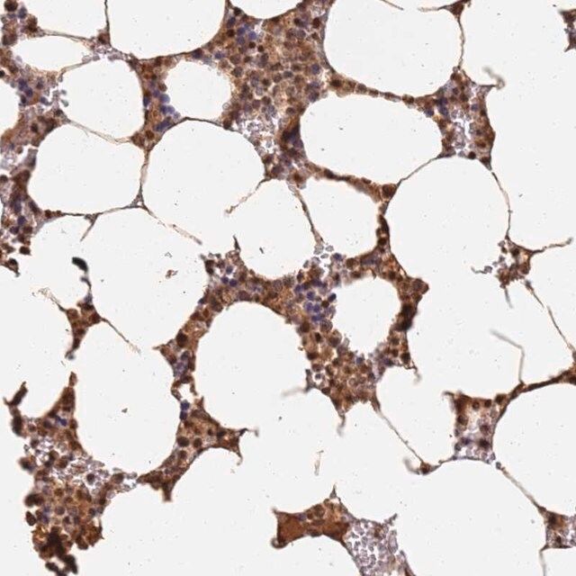 Anti-JAK2 antibody produced in rabbit