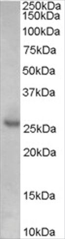 Anti-KIP1/CDKN1B, Internal antibody produced in goat