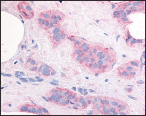 Anti-KDR (AB2) antibody produced in rabbit