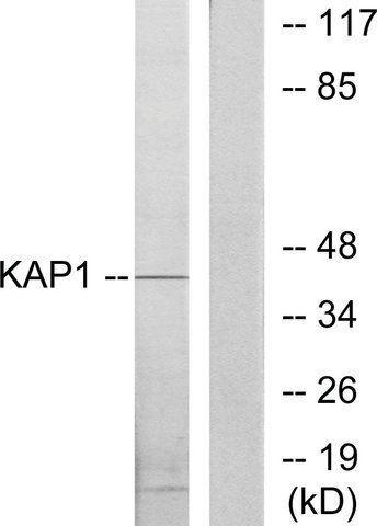 Anti-KAP1 antibody produced in rabbit