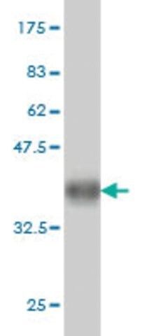 ANTI-KIT antibody produced in mouse