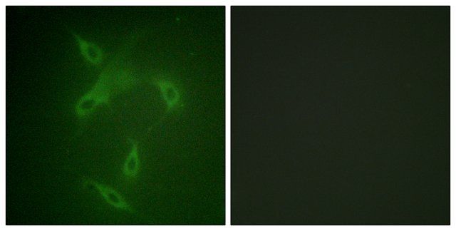 Anti-JAK2 antibody produced in rabbit