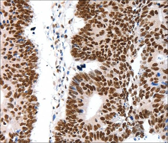 Anti-LIFR antibody produced in rabbit