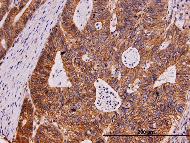 ANTI-KIT antibody produced in mouse